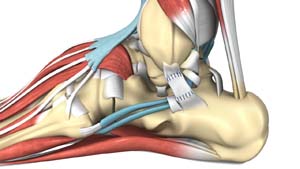 Sprains/Strains